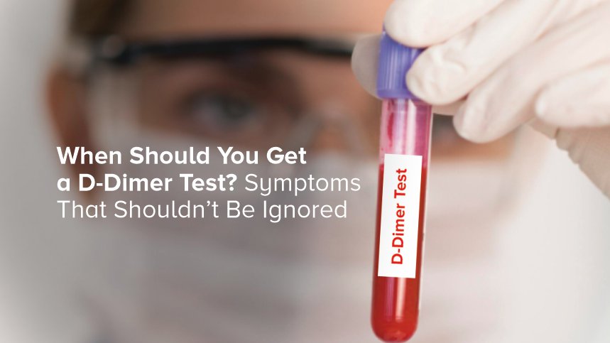 When Should You Get a D-Dimer Test?